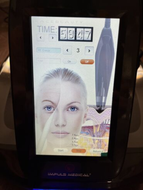 Продаю аппарат для косметологических процедур — RFV Collagen Бишкек - изображение 4